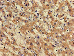 PHF21A Antibody