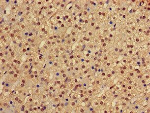 PHF21A Antibody