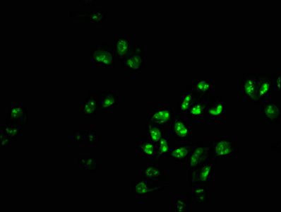 PHF6 Antibody