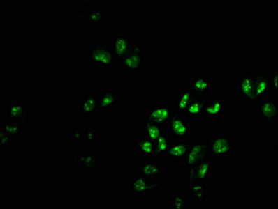 PHF6 antibody