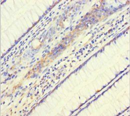 PHF6 Antibody