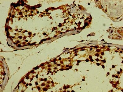 PHF6 Antibody