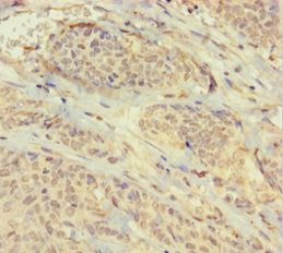 PHF6 Antibody