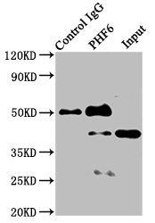 PHF6 antibody