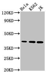 PHF6 Antibody