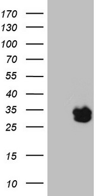 PHGDH Antibody