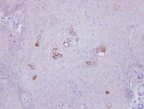 PHKA1 antibody [C2C3], C-term