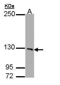PHKA1 antibody [C2C3], C-term