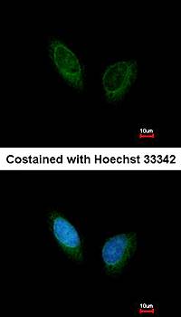 PHKA1 antibody