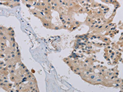 PHKA2 Antibody