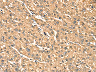 PHKB Antibody