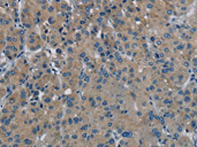 PHKG1 antibody