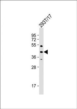 PHKG2 antibody