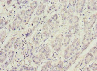 PHKG2 Antibody