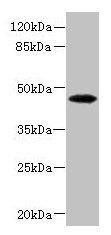 PHKG2 Antibody