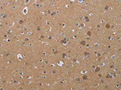 PHKG2 Antibody