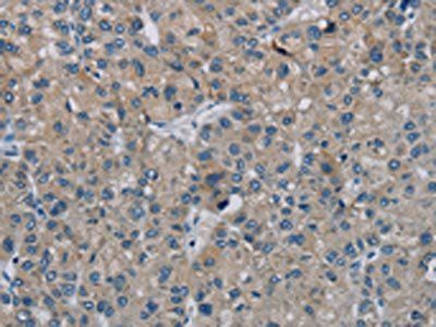 PHKG2 Antibody