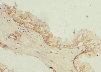 PHLDA2 Antibody