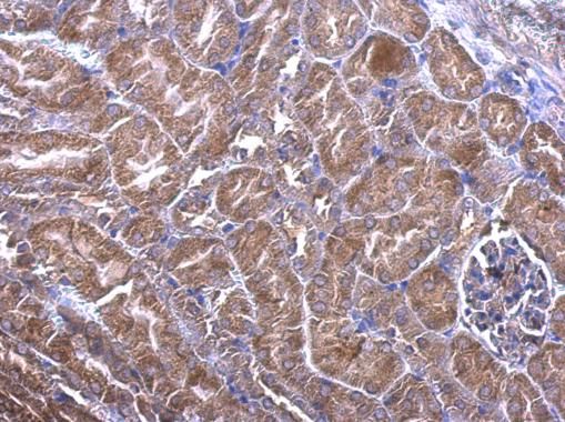 PHLP antibody