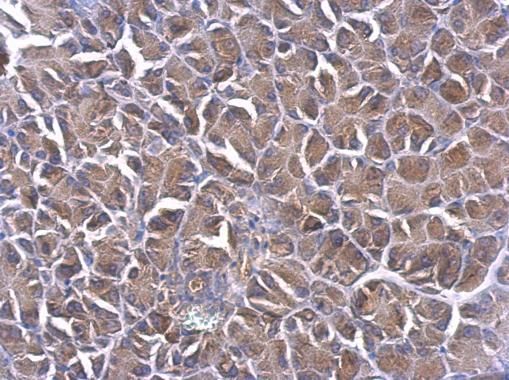 PHLP antibody