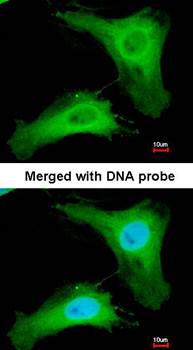 PHLP antibody