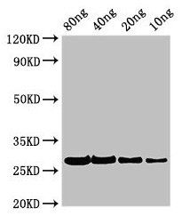 PHLPII Antibody
