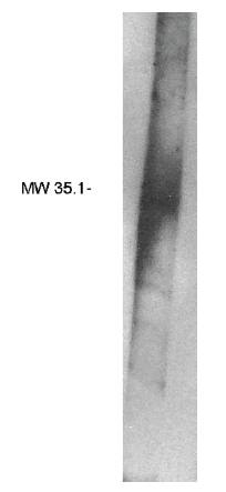 Rabbit anti Human Phosphatidic Acid Phosphatase 2B Antibody