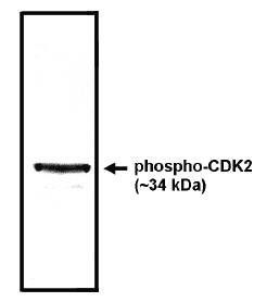 Rabbit anti Human cyclin dependent kinase 2 Antibody
