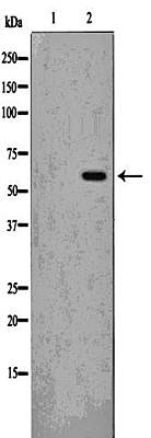 Phospho-Src (Tyr527)[Tyr530] Antibody