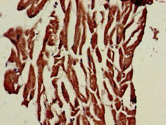 PHOSPHO1 Antibody