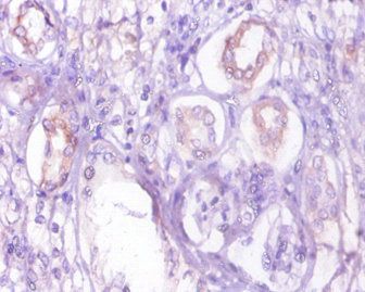 PCK1 Antibody