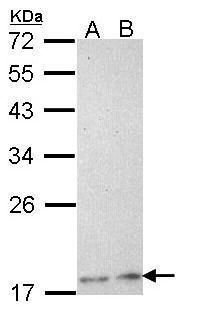 PCNP antibody [N1N2], N-term