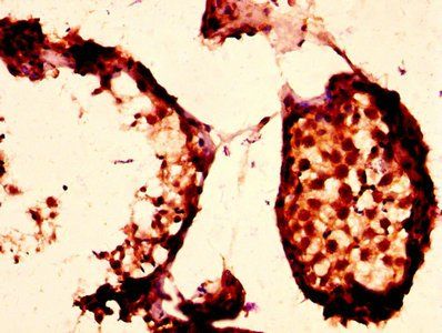 Phospholipid transfer antibody