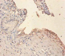 PLTP Antibody