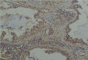 Phosphoserine Antibody