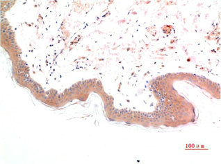 Phospho-SMAD3(S425) Monoclonal Antibody