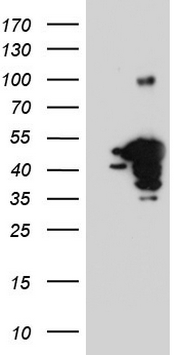 PIK3CA Antibody