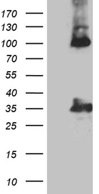PIK3CA Antibody