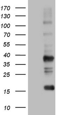 PIK3CA Antibody