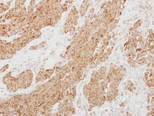 Protease Inhibitor 15 antibody [C2C3], C-term