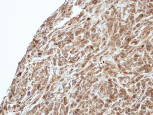 PI3 kinase p55 gamma Rabbit Polyclonal Antibody