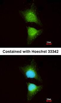 PI3 Kinase p110 beta antibody