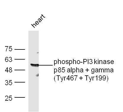 Phospho-PI3 kinase p85 alpha + gamma (Tyr467 + Tyr199) antibody