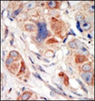 PI3KCD antibody