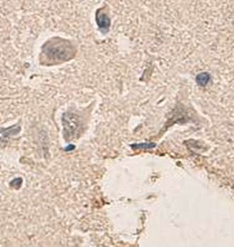 PIK3R2 Rabbit Polyclonal Antibody