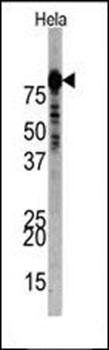 PI3KR1 antibody