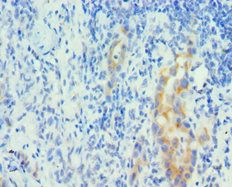 PIAS1 Antibody
