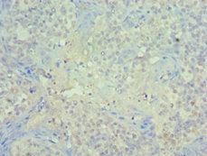 PIAS1 Antibody