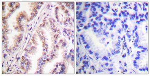 PIAS1 Antibody