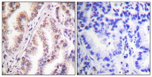 PIAS1 antibody